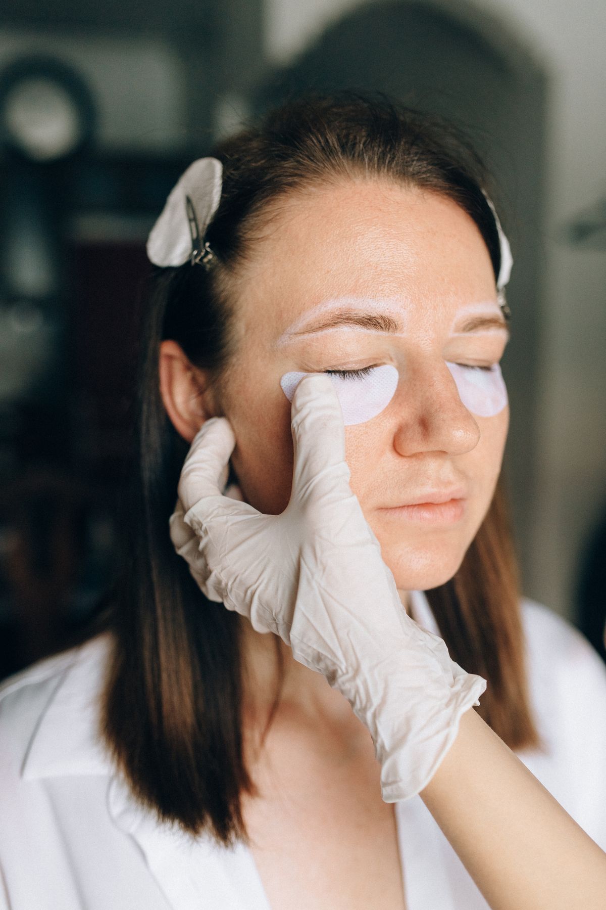 Piel deshidratada: fotografía editorial de parches hidratantes en el contorno de ojos
